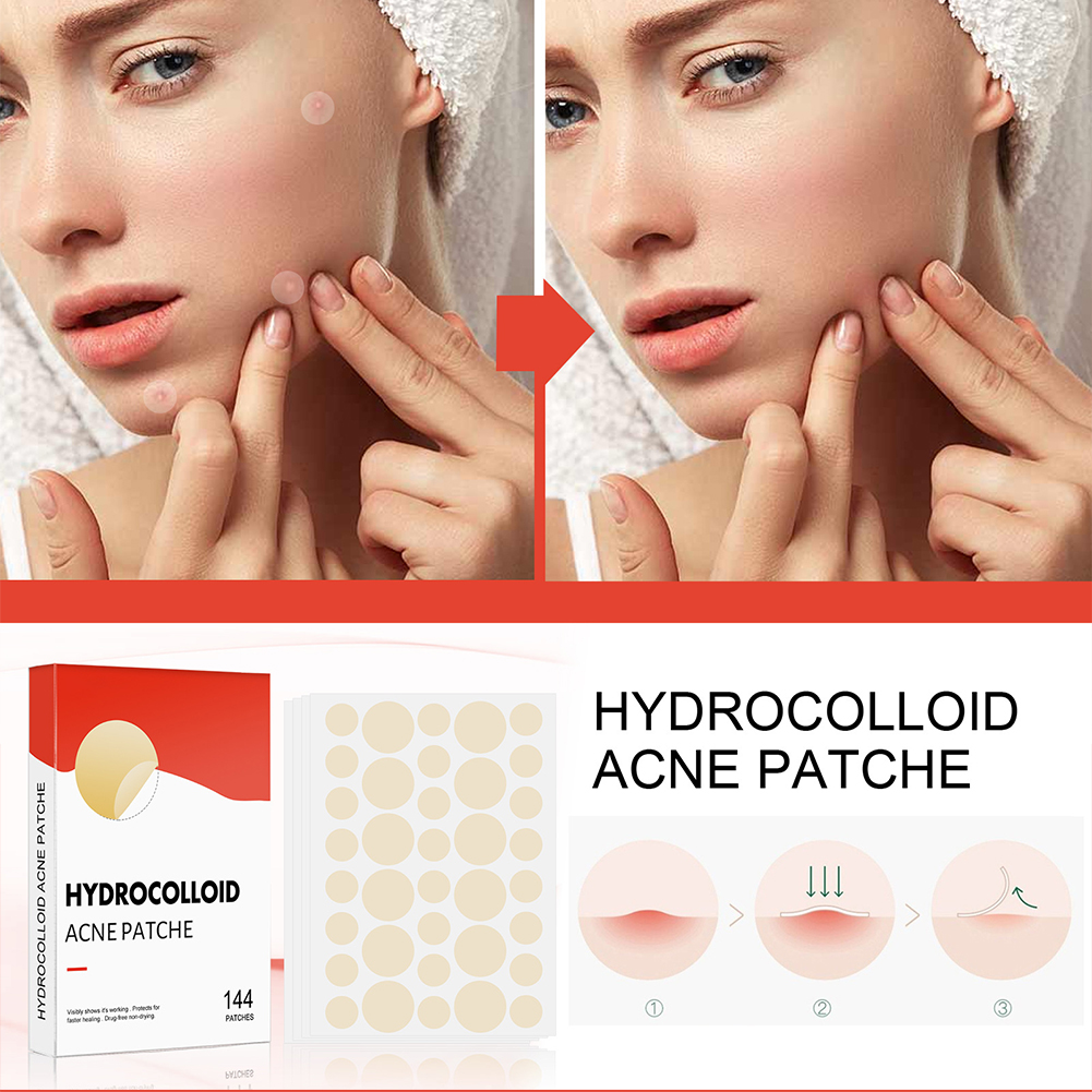 144pcs/set Face Skin Care Acne - Men Accessories Combo ulasan dan harga